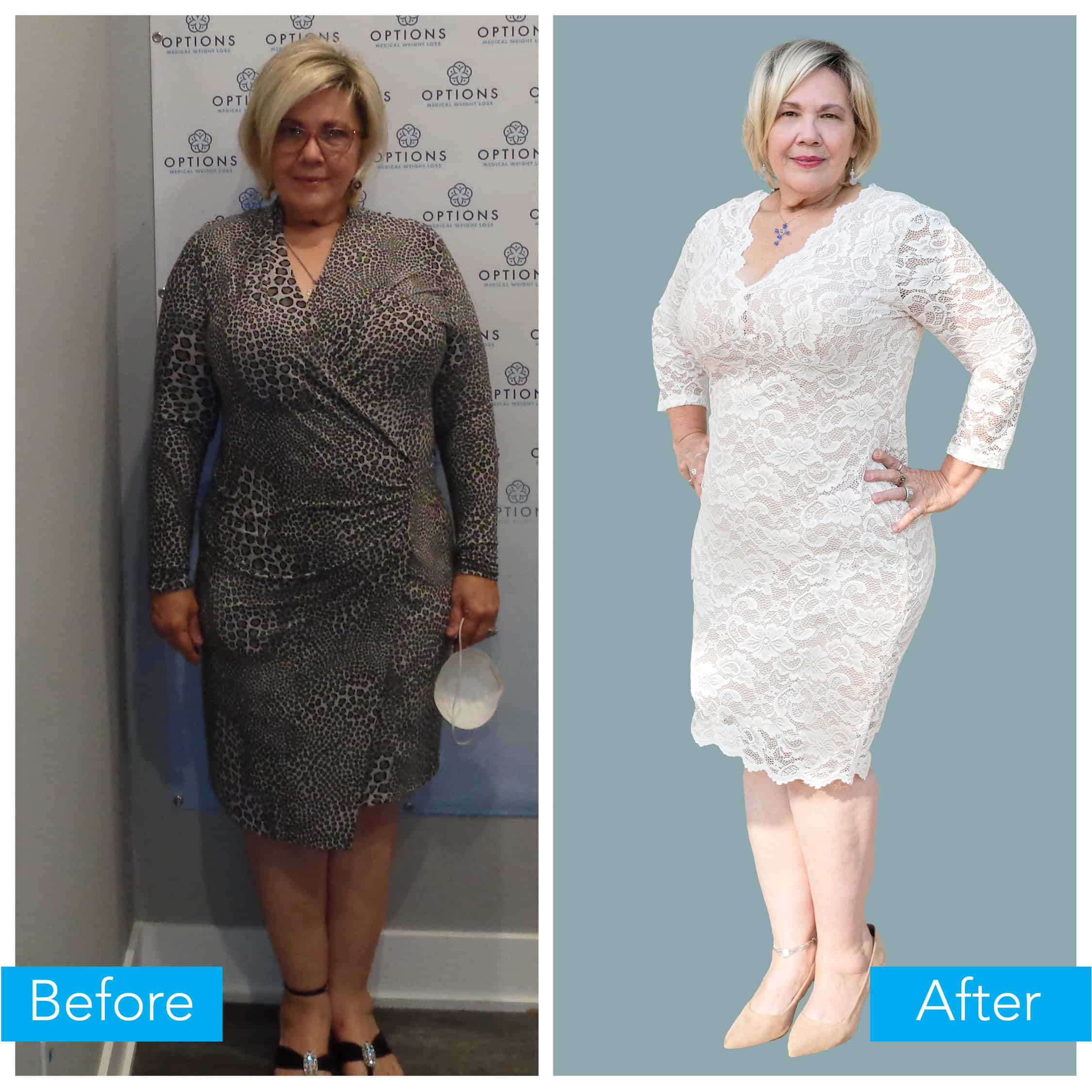 Susan weight loss before and after