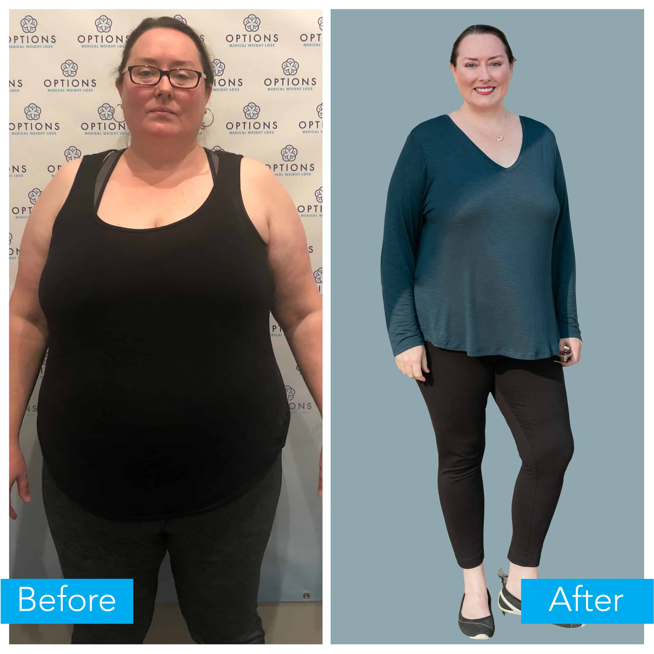 Kelly weight loss before and after