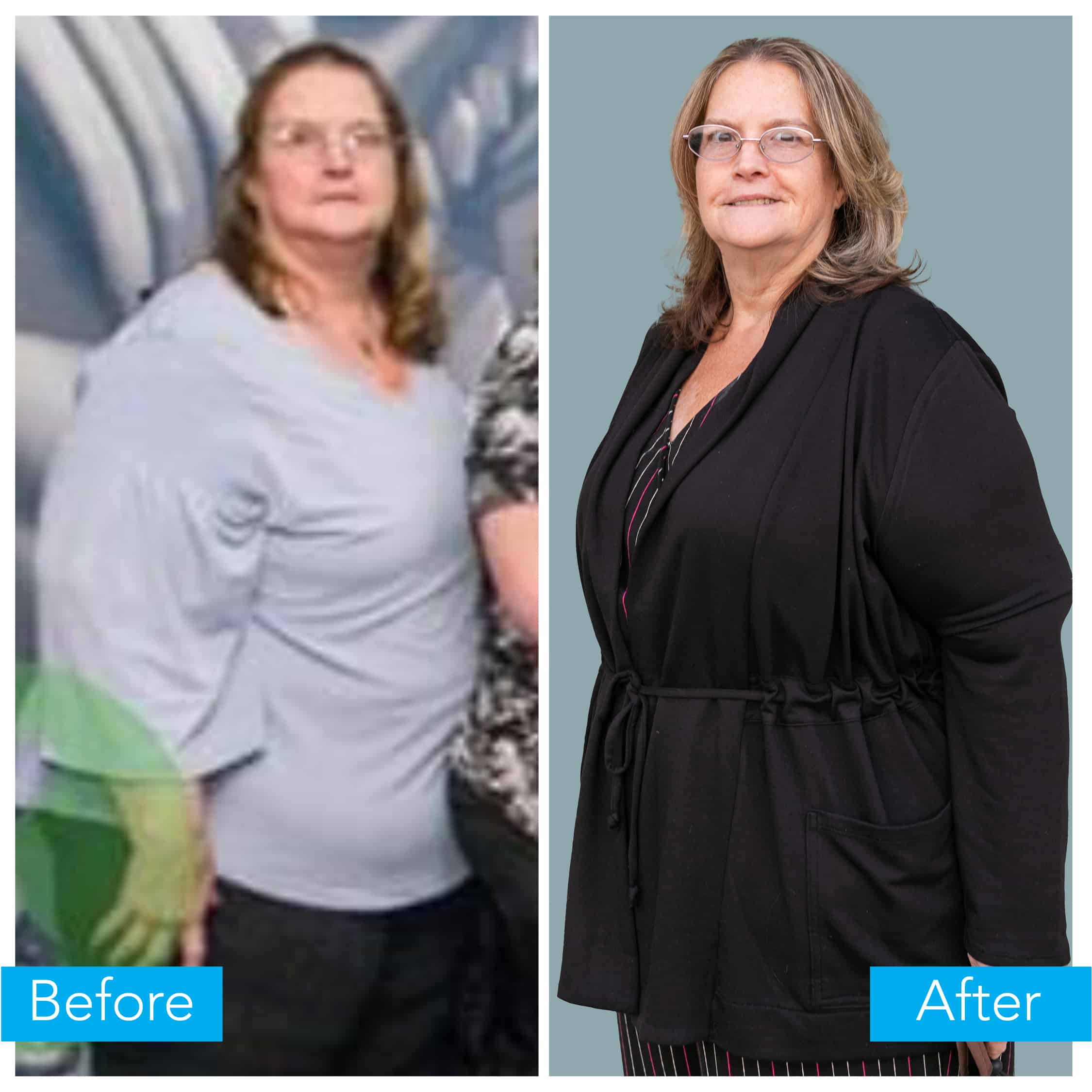 Jo Ellyn weight loss before and after